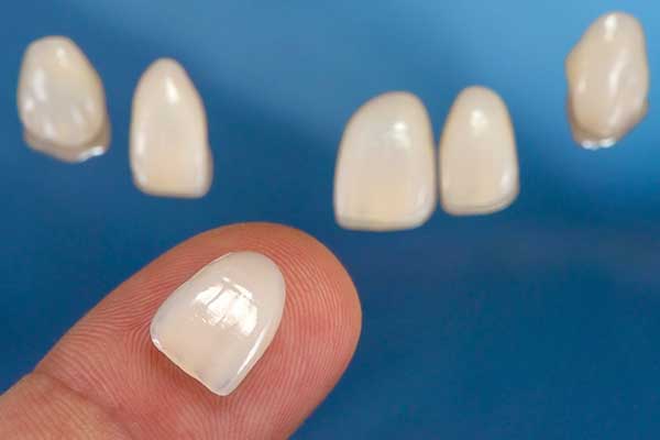 Porcelain Veneers in Manhattan, NY